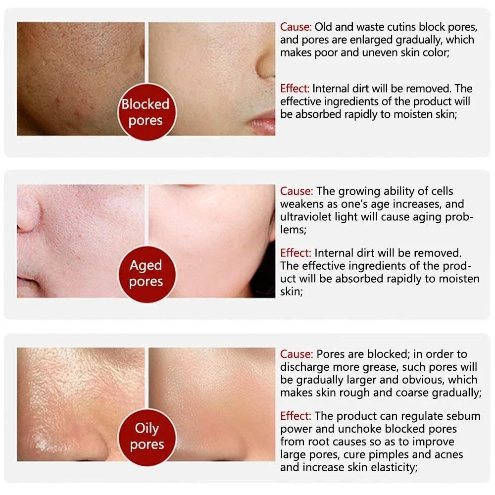 Sérum Facial Retinol e Niacinamida — Poros Refinados e Iluminação