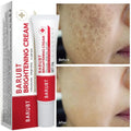 Creme Facial Clareador de Manchas e Sardas — Anti-Envelhecimento