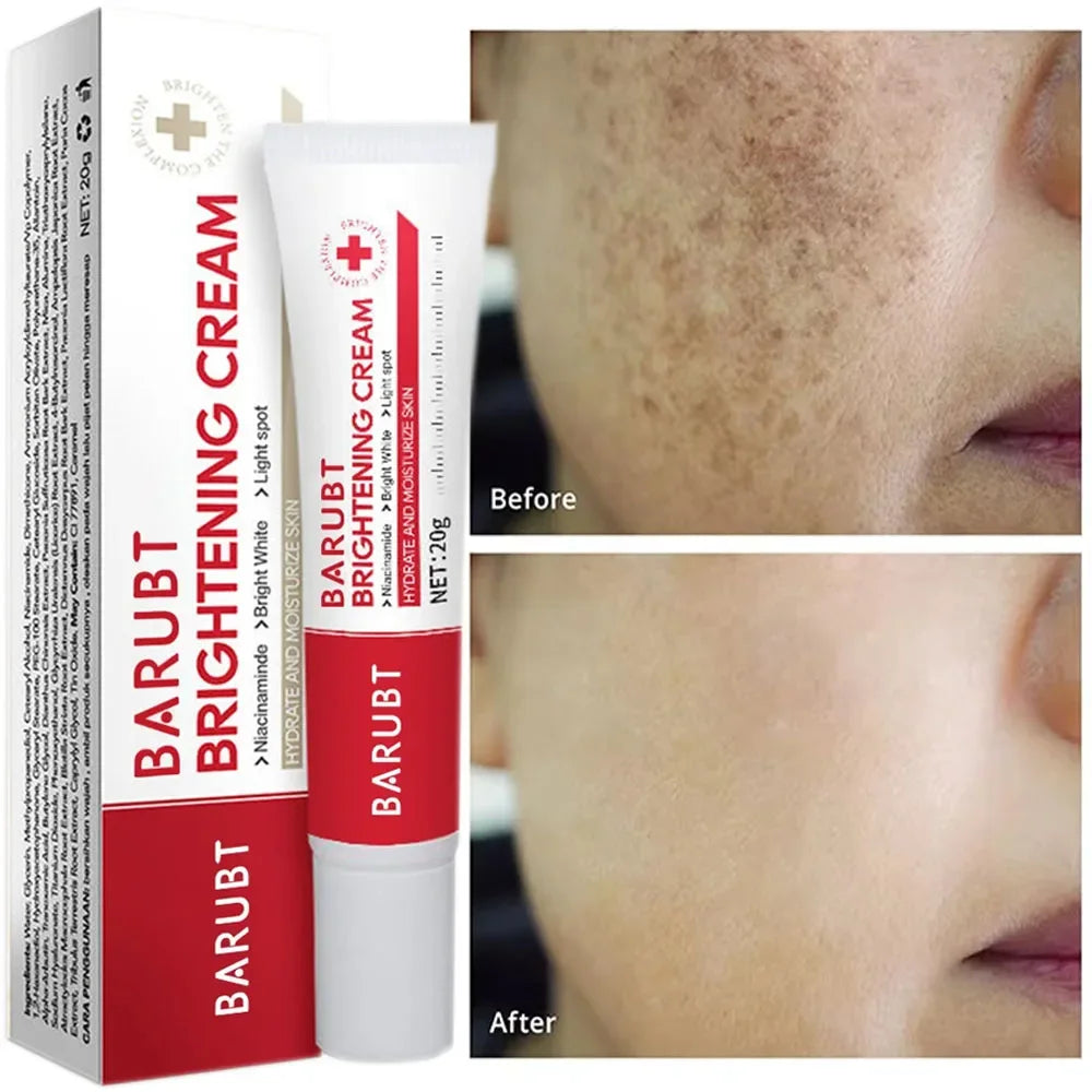 Creme Facial Clareador de Manchas e Sardas — Anti-Envelhecimento