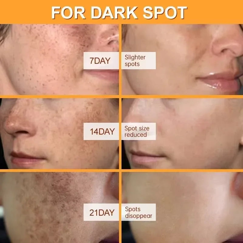 Creme Facial Clareador de Manchas e Sardas — Anti-Envelhecimento
