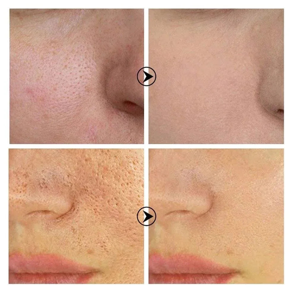 Bálsamo Stick Anti-Rugas de Colagénio — Lifting e Firmeza Coreano