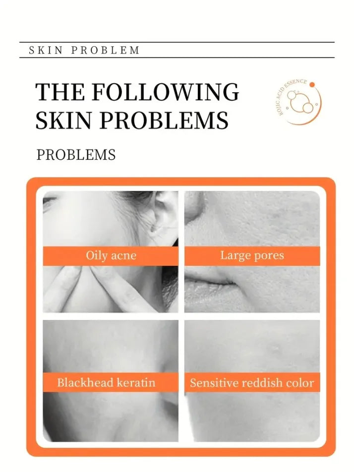 Sabão de Ácido Kójico 100g com Vitamina C, Cúrcuma e Retinol — Limpeza e Nutrição